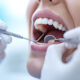 3-everyday-habits-that-are-secretly-hurting-your-teeth