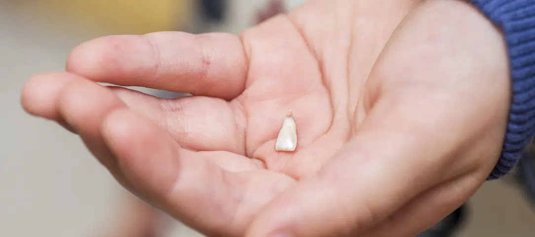 4-Things-to-Remember-in-a-Dental-Emergency