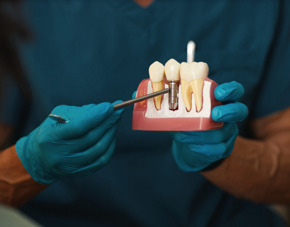 5-signs-youre-a-candidate-for-dental-implants