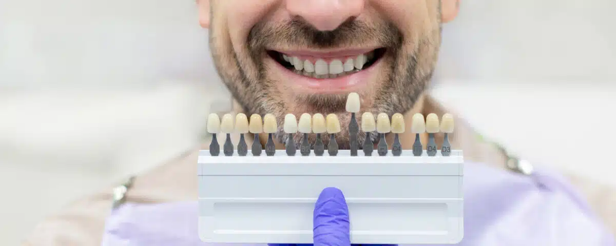 are-veneers-a-permanent-option