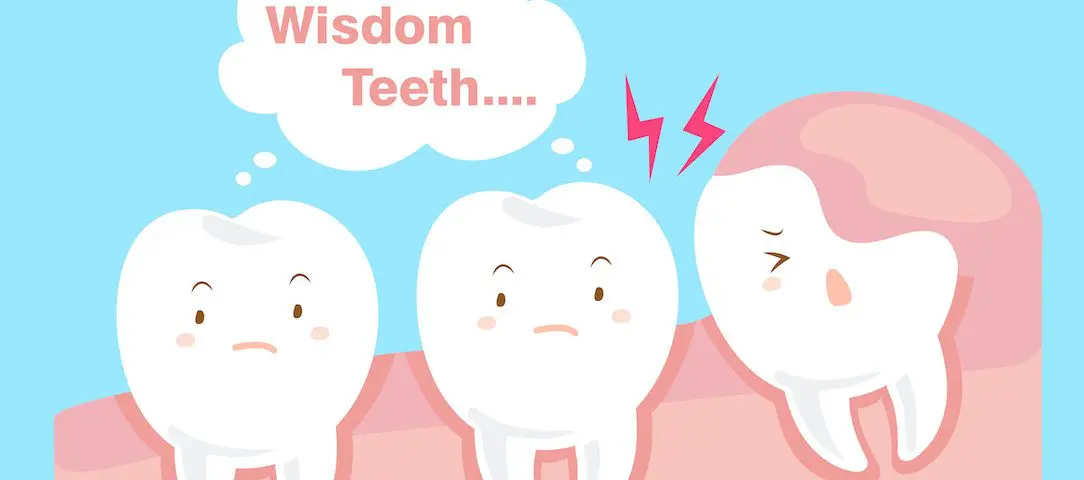 caring-for-your-smile-after-wisdom-teeth-removal