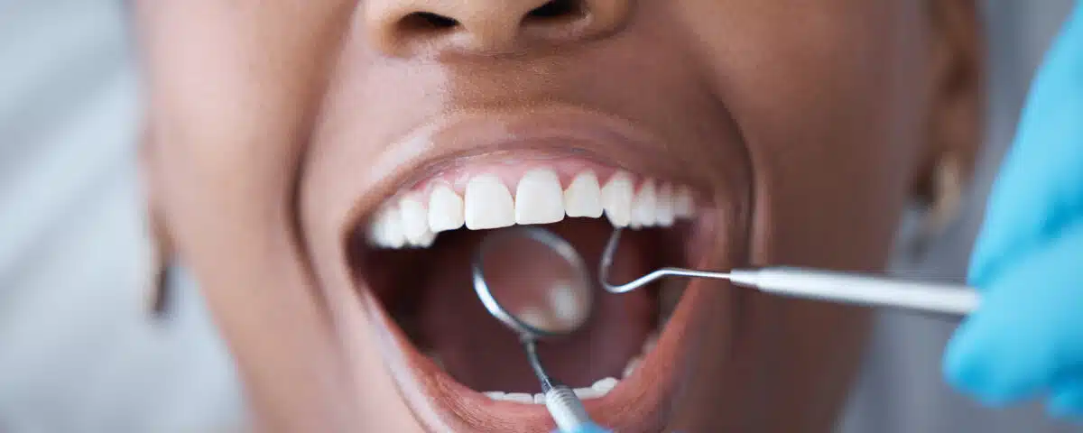 dental-insurance-reminder-use-your-2025-benefits-before-they-expire