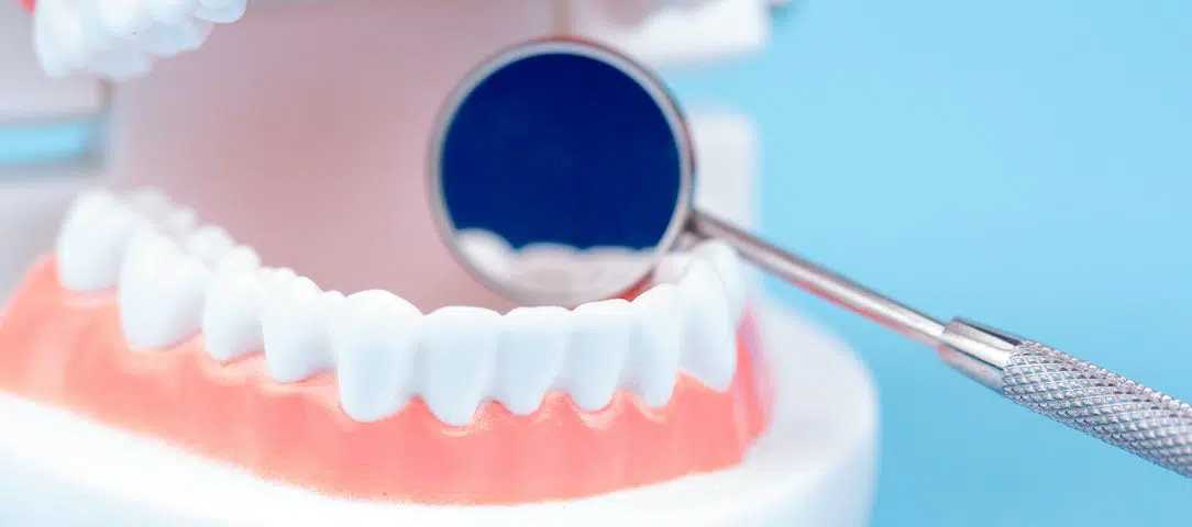 do-healthy-people-need-dental-checkups