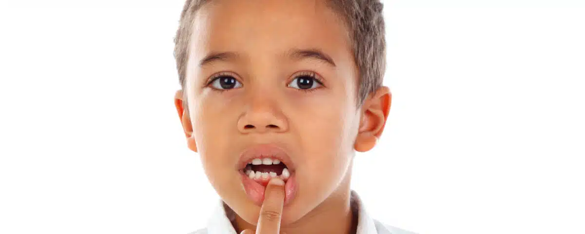 fast-action-steps-to-follow-when-your-child-knocks-out-a-tooth