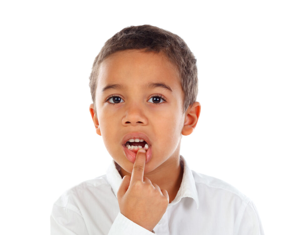 fast-action-steps-to-follow-when-your-child-knocks-out-a-tooth