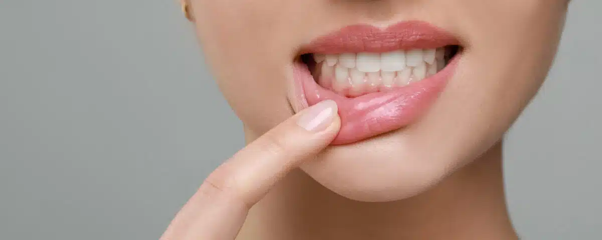 gum-disease-and-your-heart