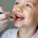 how-dental-sealants-benefit-kids