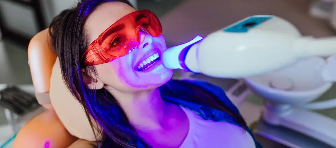 how-to-make-your-teeth-whitening-results-last-longer