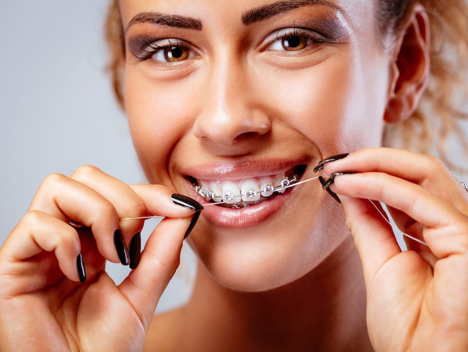 how-to-properly-clean-your-teeth-with-braces