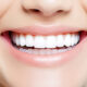 instant-smile-makeover-all-you-need-to-know-about-dental-veneers