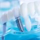 is-it-time-for-dental-implants