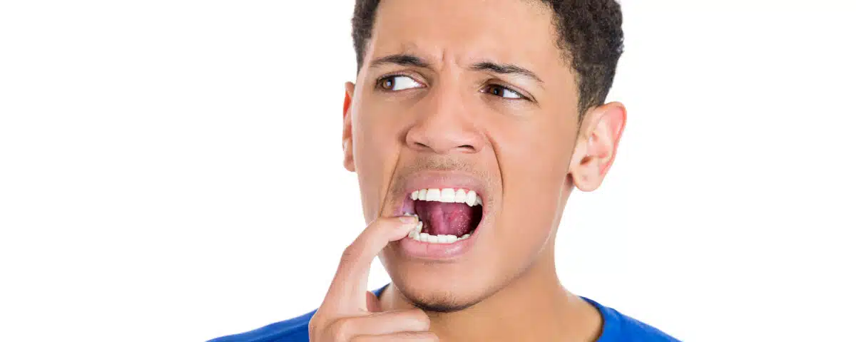 know-the-signs-do-you-need-a-root-canal