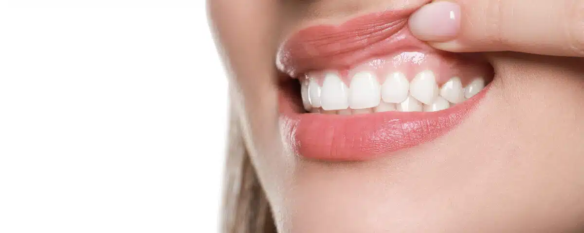 listen-to-your-smile-what-your-gums-and-teeth-say-about-oral-health