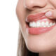 listen-to-your-smile-what-your-gums-and-teeth-say-about-oral-health