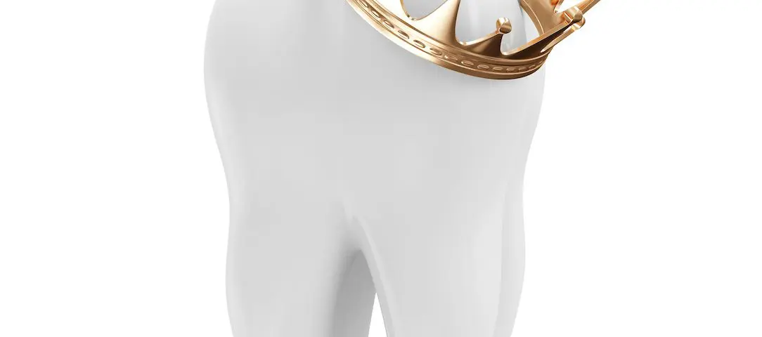 makeover-your-smile-with-same-day-crowns