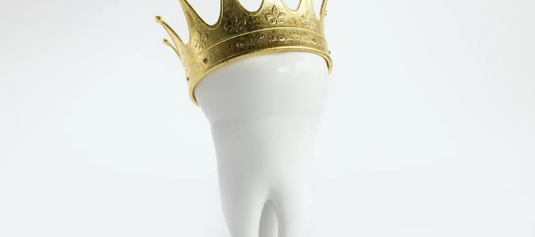 put-a-cap-on-it-with-same-day-dental-crowns