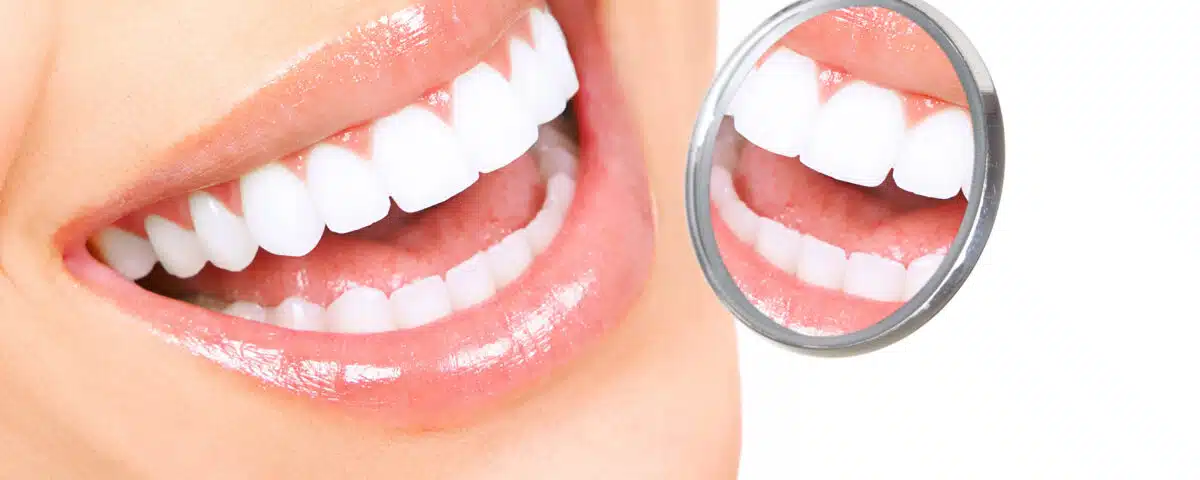 reclaim-your-smile-with-full-mouth-restoration-at-mountain-aire-dentistry