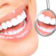 reclaim-your-smile-with-full-mouth-restoration-at-mountain-aire-dentistry