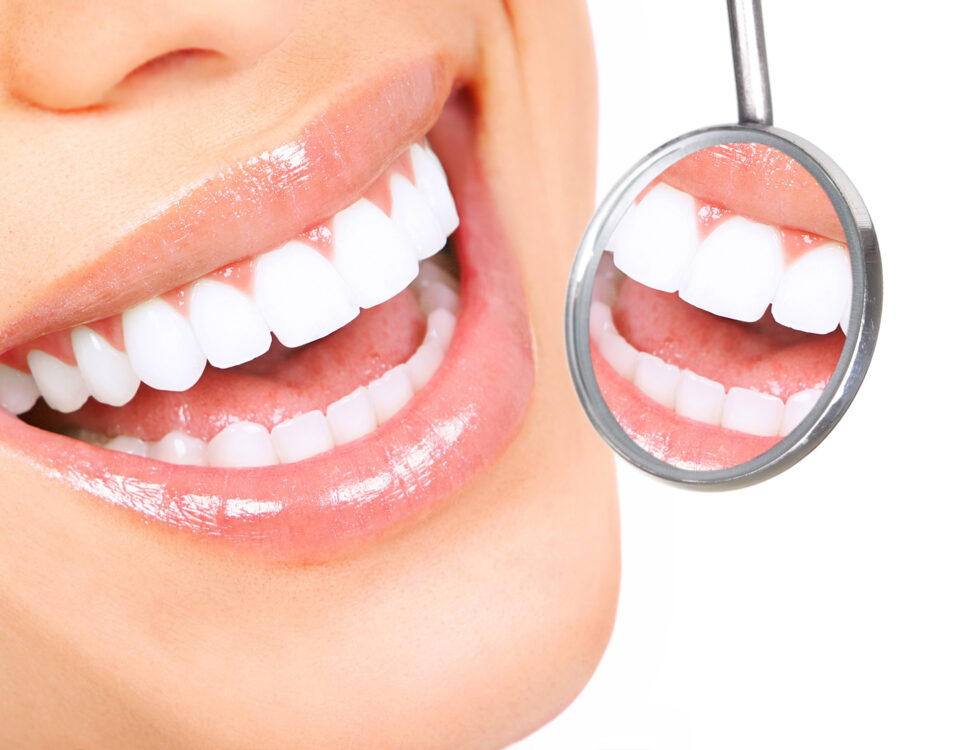 reclaim-your-smile-with-full-mouth-restoration-at-mountain-aire-dentistry