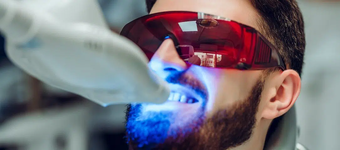 the-7-day-guide-to-whiter-teeth