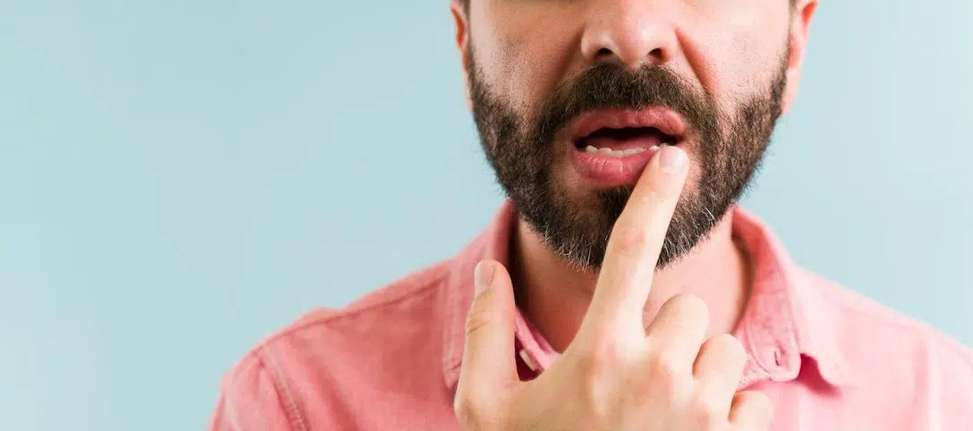 the-causes-of-dry-mouth-whats-causing-your-problems