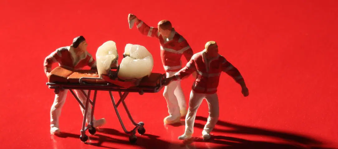 The-Complete-Guide-What-to-Know-in-a-Dental-Emergency