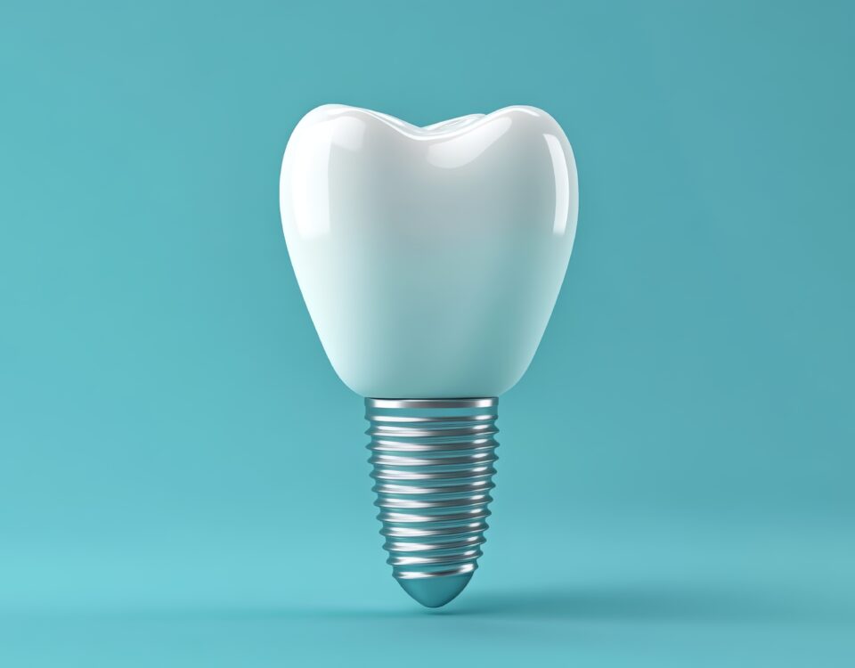 the-dental-implant-recovery-process-with-mountain-aire-dentistry