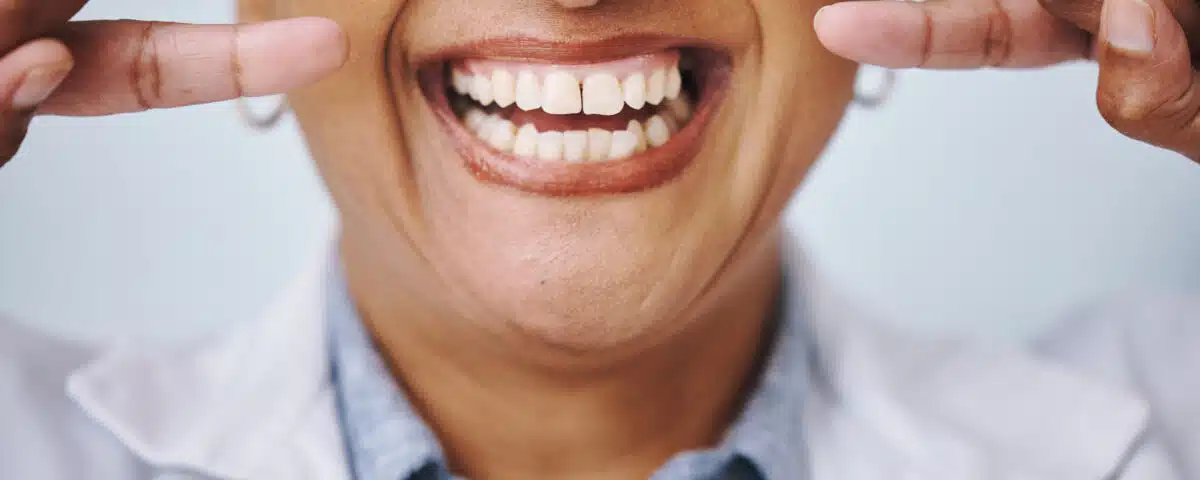 The Miracle of Dental Crowns and Bridges