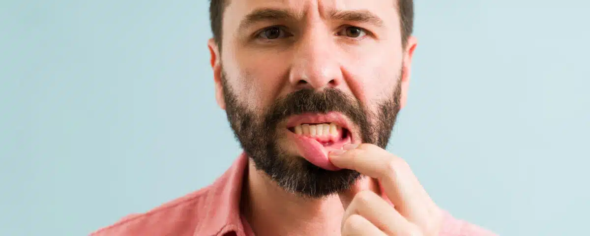 the-risks-of-not-treating-gingivitis