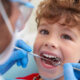the-role-of-dental-sealants-in-protecting-your-teeth