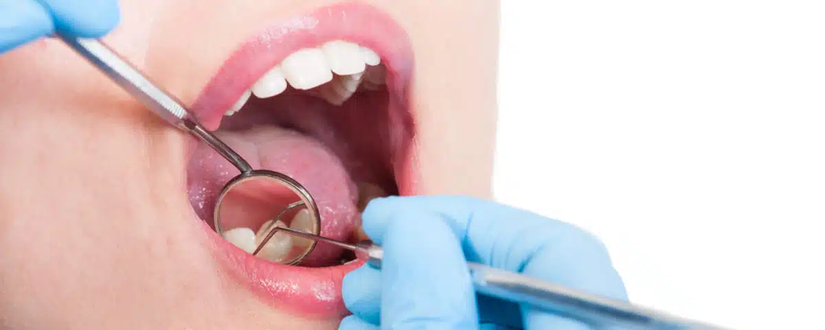 tips-for-preventing-plaque-buildup-and-maintaining-good-oral-health