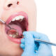 tips-for-preventing-plaque-buildup-and-maintaining-good-oral-health