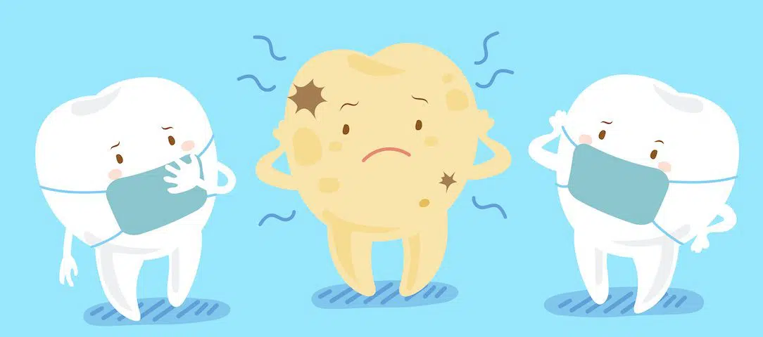 understanding-how-tooth-decay-destroys-your-tooth