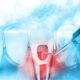 what-is-root-canal-therapy
