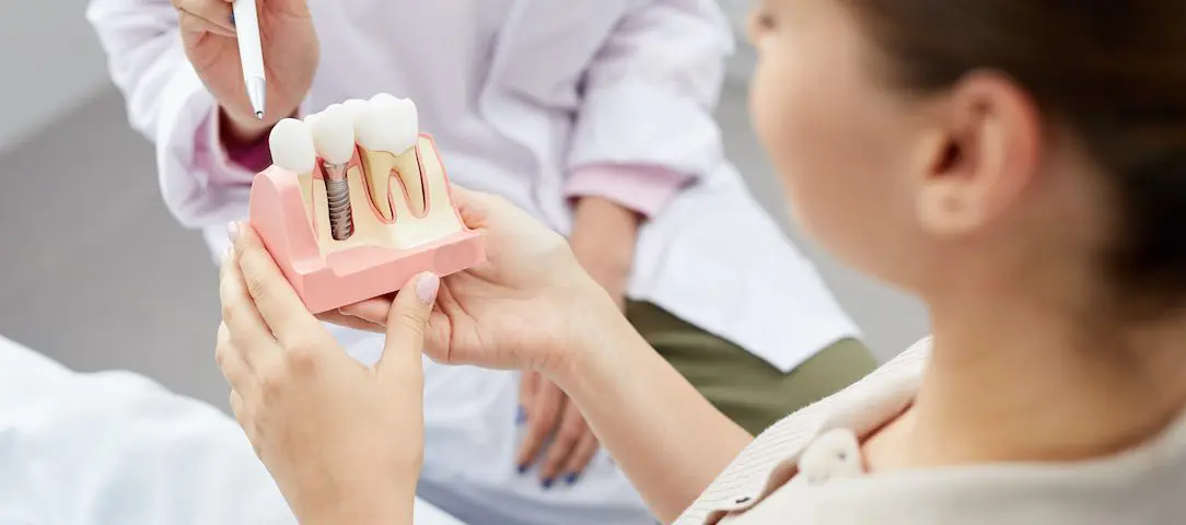 what-is-the-dental-implant-recovery-process-like