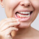 what-your-gums-are-telling-you-early-signs-of-gum-disease