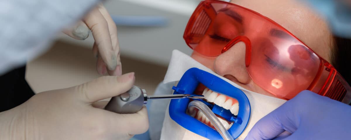 why-professional-teeth-whitening-beats-diy-kits