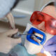why-professional-teeth-whitening-beats-diy-kits