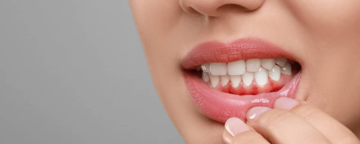 why-your-gums-bleed-when-you-brush