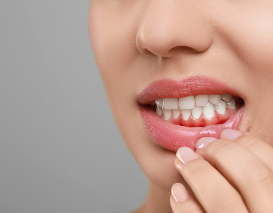 why-your-gums-bleed-when-you-brush